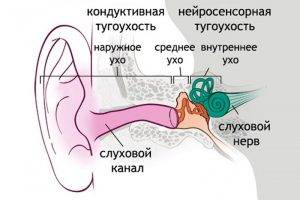 Острый отит, причины и лечение острого отита среднего уха без температуры, причины и последствия