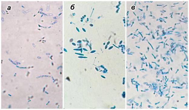 Маслянокислые бактерии - cheesehead.ru | cheesehead.ru