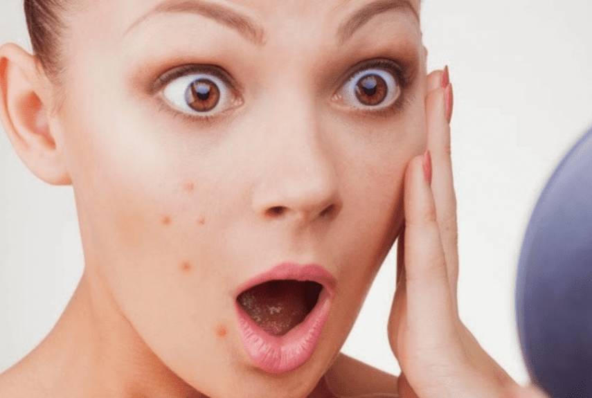 Аллергический дерматит: симптомы и лечение у взрослых