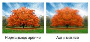 Исследование остроты зрения