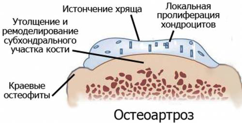 Отзывы noltrex