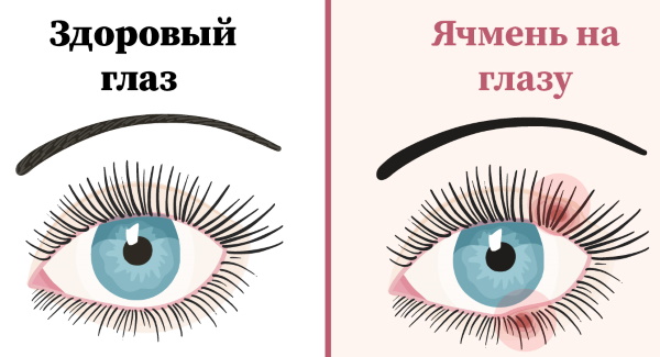 Тобрекс