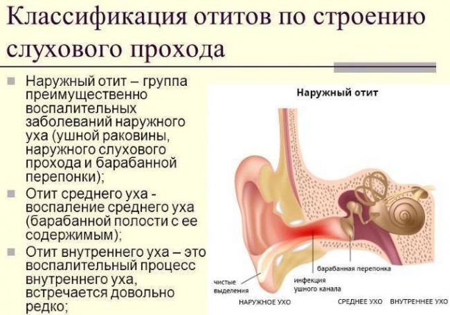 Воспаление среднего уха: возникновение и причины, проявления, диагностика, лечение