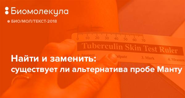 Целесообразность проведения анализа мочи на туберкулез методом пцр