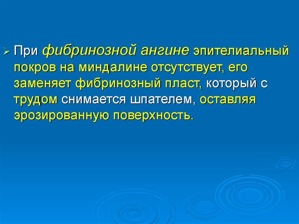 Ангина венсана-симановского — описание, лечение, симптомы
