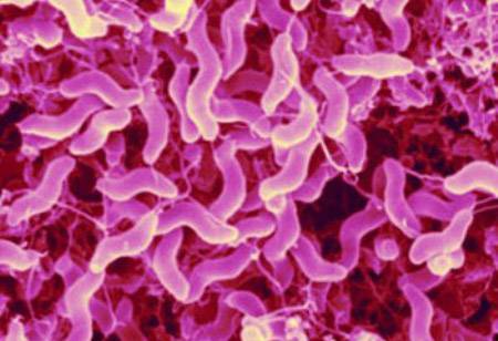 Молочнокислое брожение