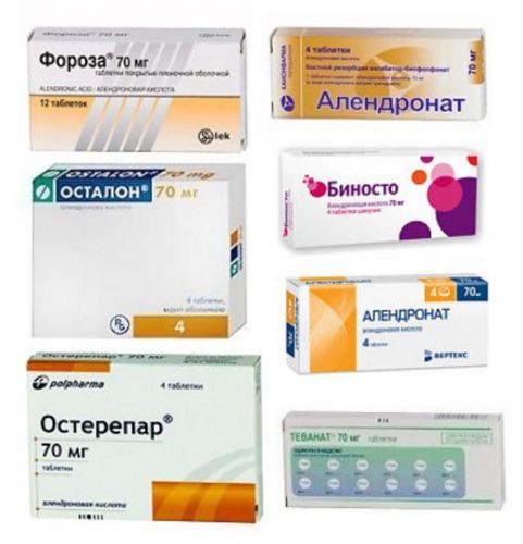 Алендроновая кислота: показания, инструкция по применению, состав, дозировка, отзывы