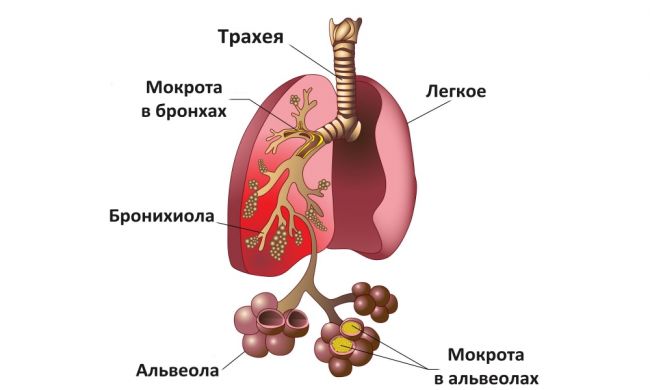 Кишечная палочка: описание видов, симптомы и методы лечения