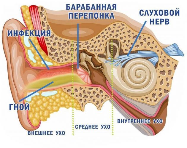 Статьи по заболеваниям, травмам внутреннего уха