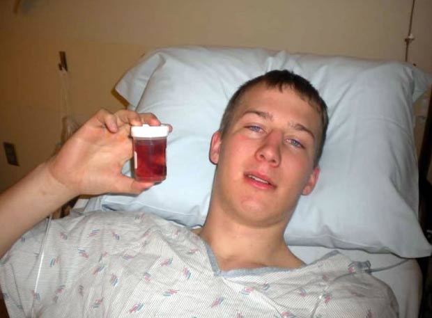 Особенности восстановительного периода после удаления миндалин