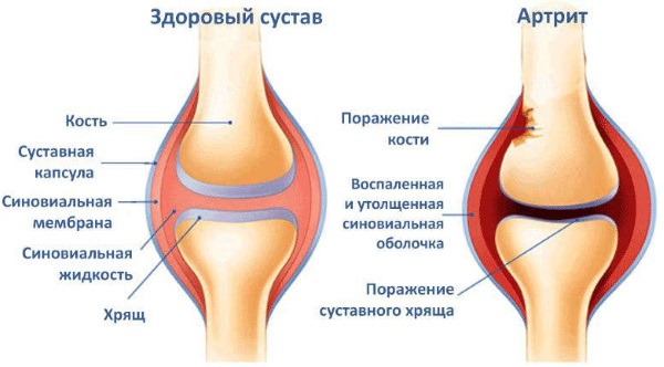 Диклофенак мазь