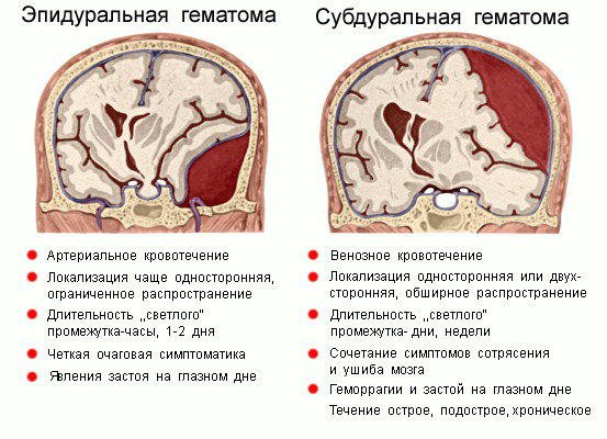Анатомия: оболочки спинного мозга. твердая оболочка, паутинная оболочка, мягкая оболочка спинного мозга