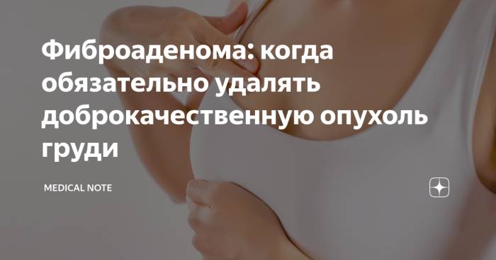 Фиброаденома молочной железы