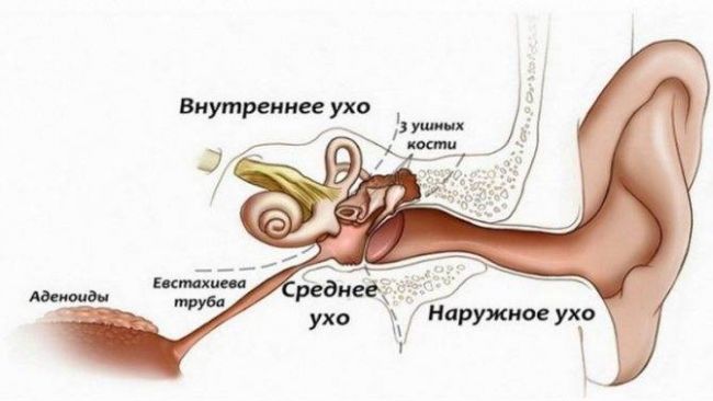 Воспаление среднего уха: развитие, симптомы, диагностика, лечение