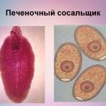 Признаки появления печеночного сосальщика у человека: симптомы и лечение