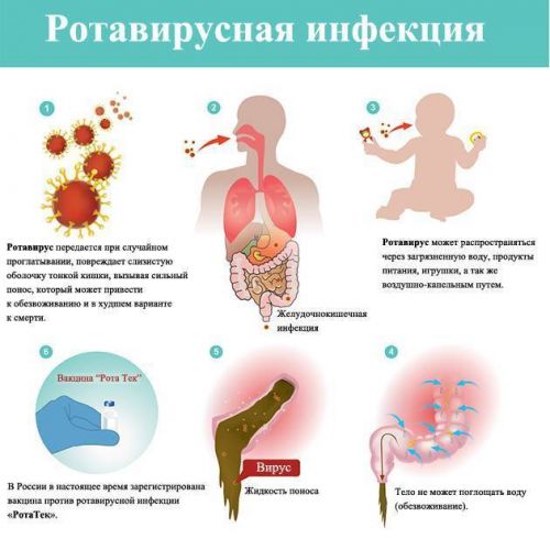Ротавирусная инфекция у детей грудного возраста, дошкольного возраста и у взрослых. симптомы, диагностика и лечение ротавирусной инфекции :: polismed.com