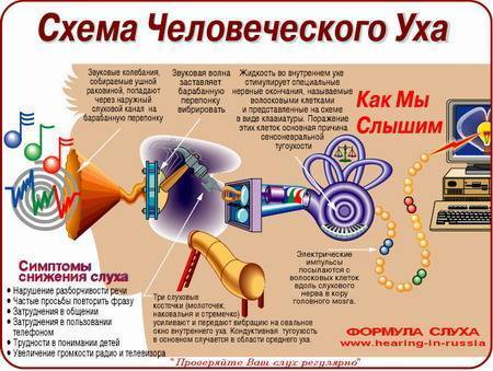 Нейросенсорная тугоухость (сенсоневральная тугоухость, кохлеарный неврит)