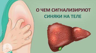 Как убрать синяк на лице
