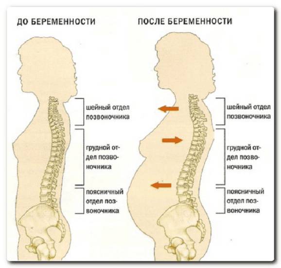 Защемило поясницу что делать