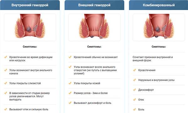 Свечи Релиф инструкция по применению и отзывы покупателей