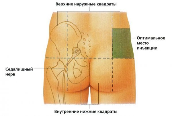 Эпиталон (agag)