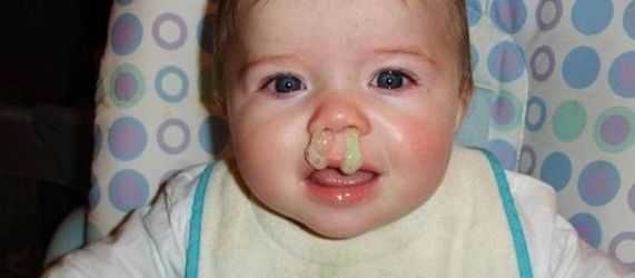 Гнойные сопли у взрослого