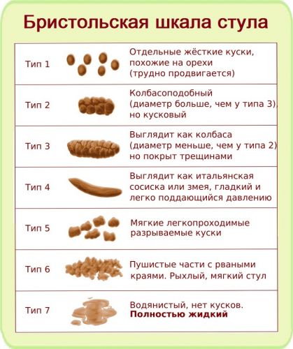 Запор у детей и взрослых: симптомы и лечение, эффективные слабительные средства