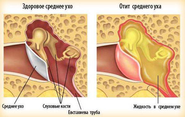 АЦЦ гранулы - официальная инструкция по применению