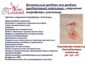Вагинальный дисбактериоз