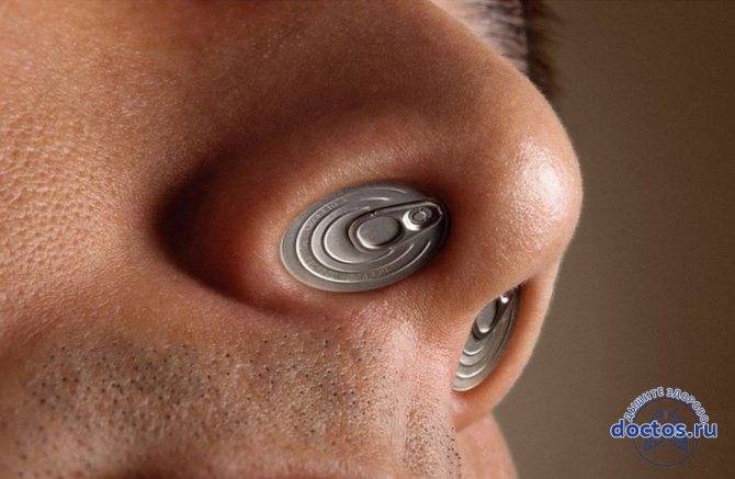 Гнойный ринит — симптомы и лечение