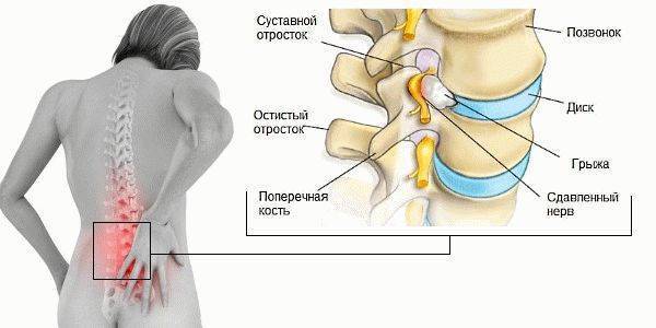 Випратокс                 инструкция по применению