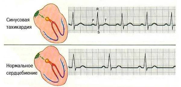 Валосердин - инструкция по применению, аналоги, отзывы и формы выпуска капли лекарственного препарата для лечения неврозов, тревожности, бессонницы у взрослых, детей и при беременности. Состав