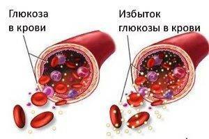 Аллергия на сахар: симптомы у взрослых с фото