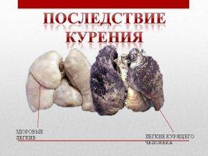 Влияние курения на органы дыхания