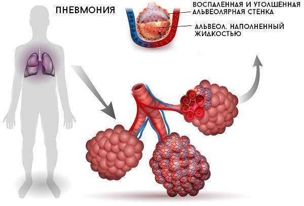Как курение табака влияет на органы дыхания и какие заболевания дыхательной системы вызывает?