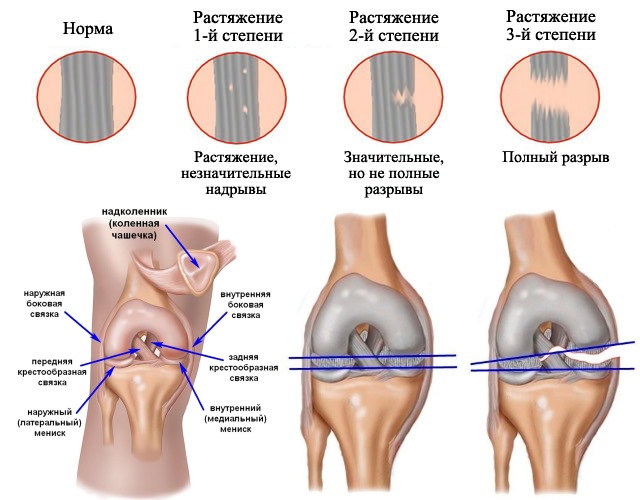 Фастум гель: инструкция по применению и для чего он нужен, цена, отзывы, аналоги