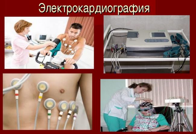 Кратковременные головокружения могут стать предвестниками деменции
