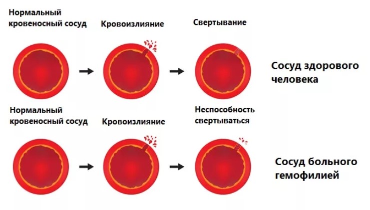Состав крови