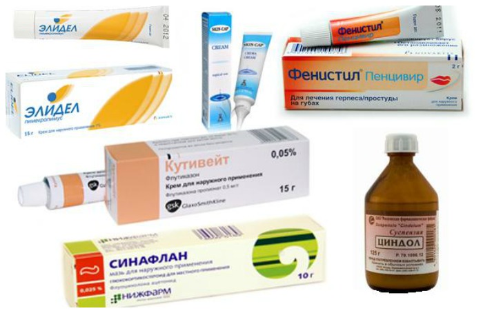 Аллергический дерматит у детей – что делать для лечения и профилактики?