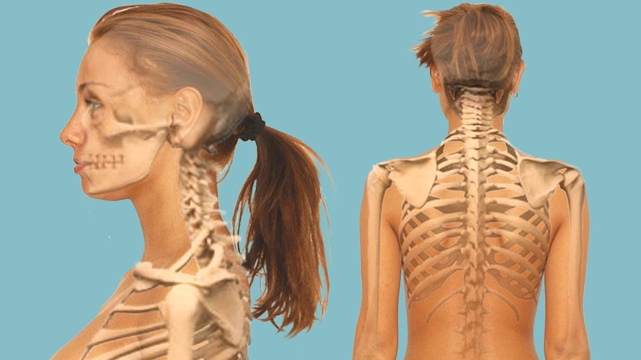 Как лечить ущемление нерва в поясничной области?