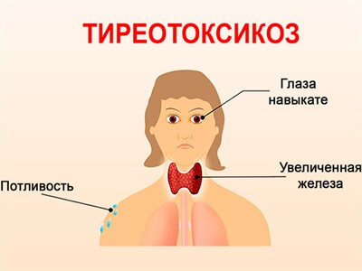Рекомендации для диеты при гипертиреозе