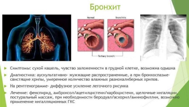 Как курение табака влияет на органы дыхания и какие заболевания дыхательной системы вызывает?