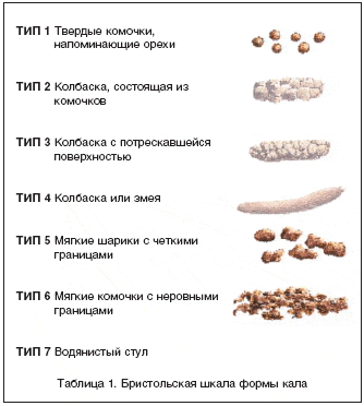 Причины запора