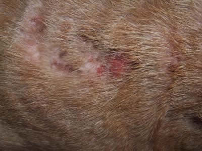 Аллергический дерматит у взрослых