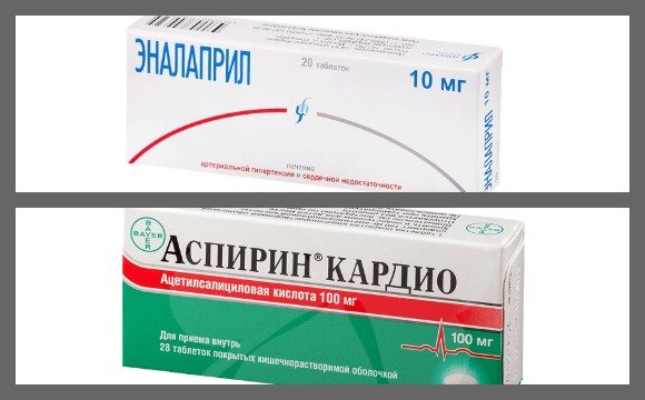 Кратковременные головокружения могут стать предвестниками деменции