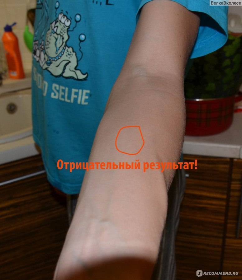 «диаскинтест» для детей: от особенностей применения до оценки результатов