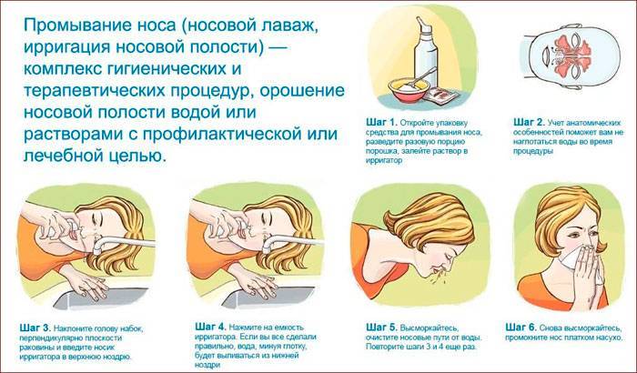 Гнойные сопли