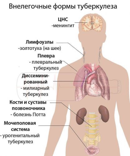 Анализ мочи на туберкулез