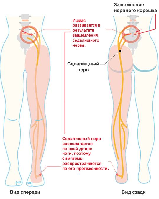 Защемление нерва в позвоночнике: симптомы и методы лечения | все о суставах и связках