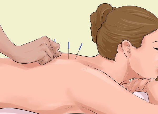 Защемление нерва в спине: что делать, если защемило, симптомы, как лечить